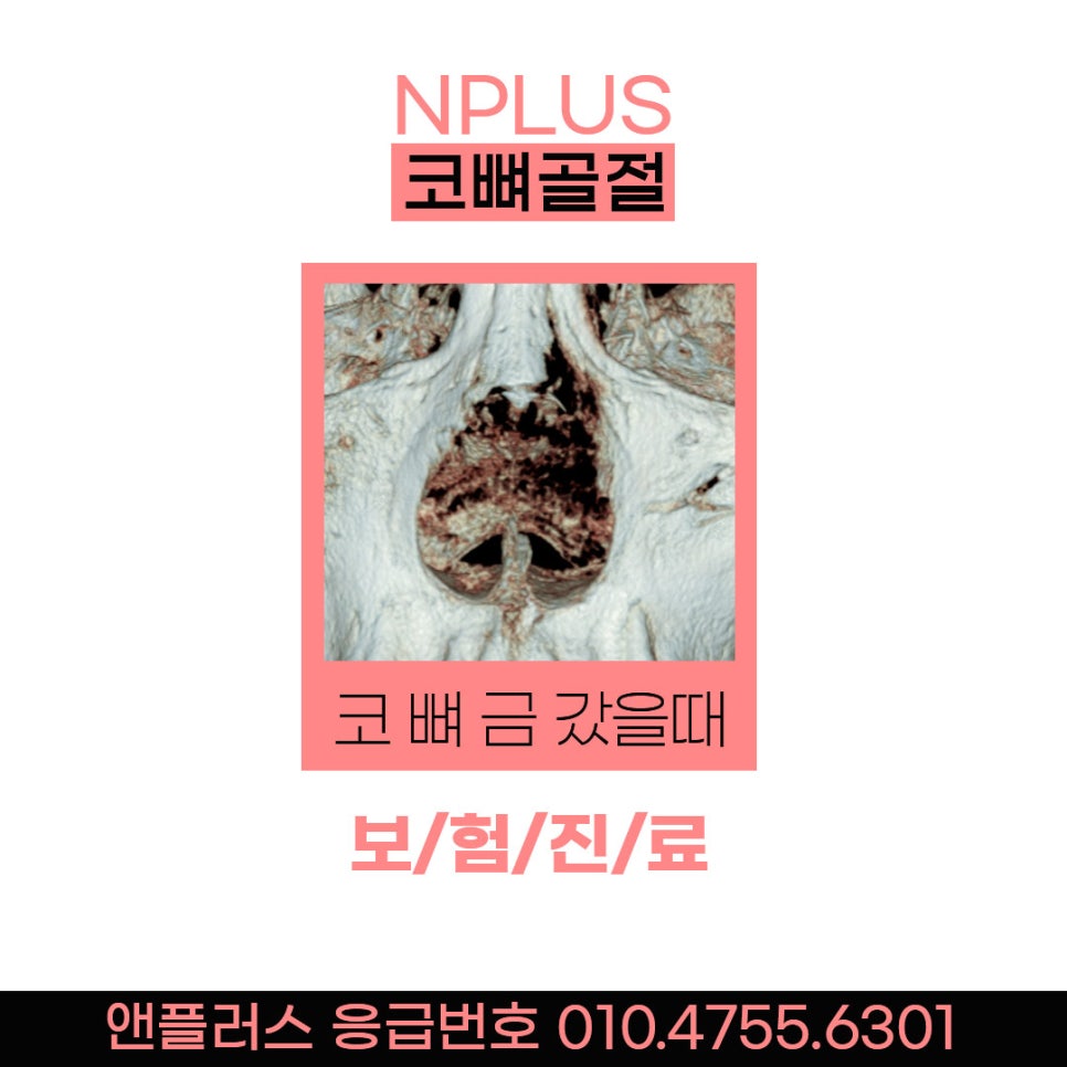 Nose Bone Fracture Emergency Consultation! Inquiries Available on Weekends/Holidays★ image 2
