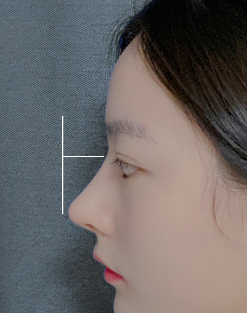 What Is the Prettiest Nose That Suits My Face Best? image 9