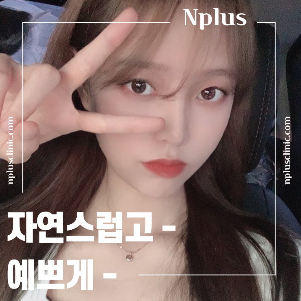 Nose Surgery Review for Correcting a Hump Nose image 2