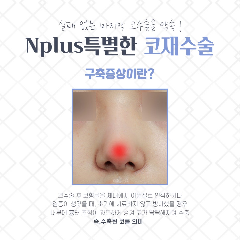 Properly Understanding Contracted Nose Revision Surgery image 5