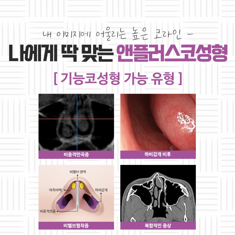자가연골코성형을 통해 자연스럽고 예쁜 라인으로 관련 이미지 9
