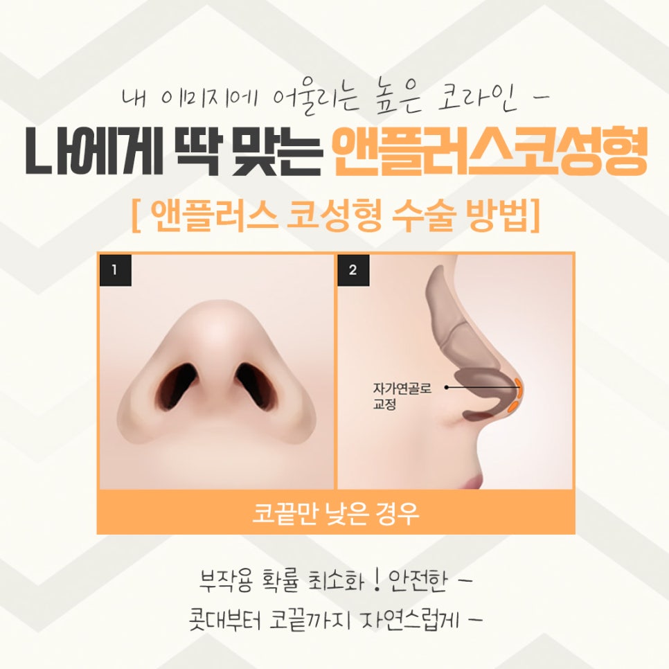 코수술후기에 대해 자세하게 알아보고 관련 이미지 10