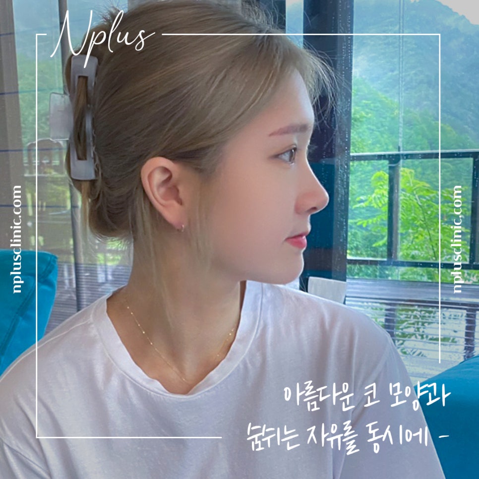 매부리코성형후기 매끈하고 예쁜코라인으로 관련 이미지 3