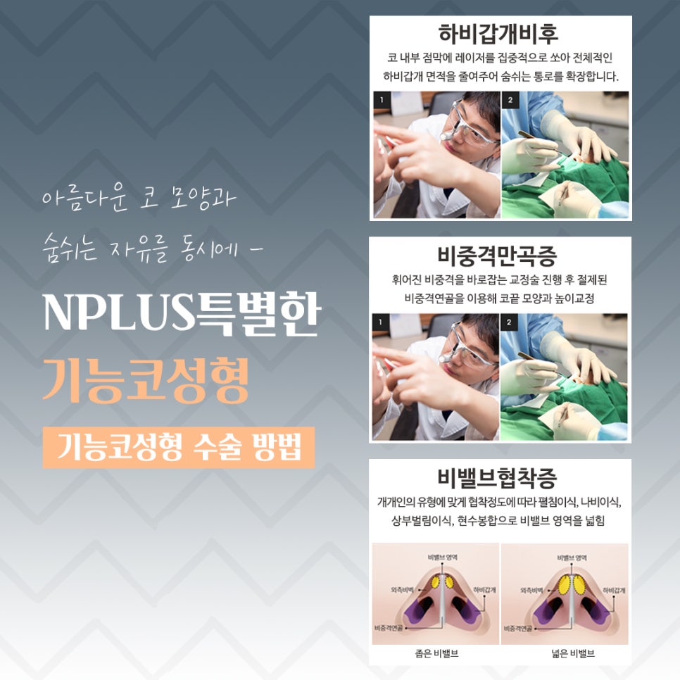 If You Are Looking in Detail at Functional Nose Surgery Before and After image 9