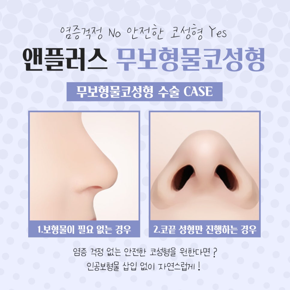 Review of Non-Implant Nose Surgery for a Beautiful Line image 8