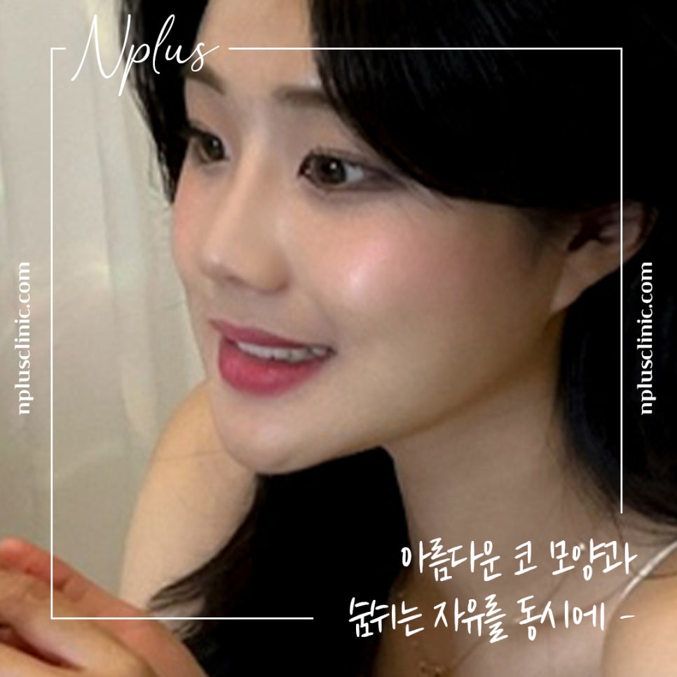 콧볼축소수술후기에 대해 알아보고 결정 관련 이미지 10