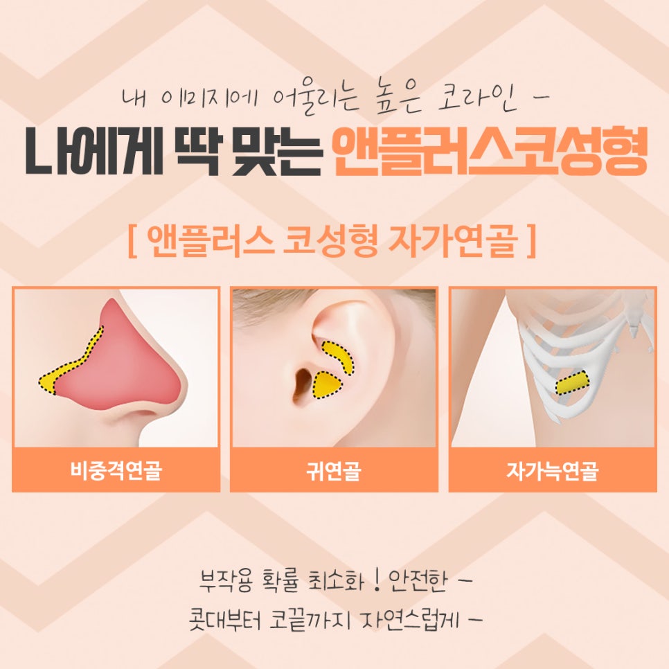 코성형 후기로 알아보고 결정 관련 이미지 13