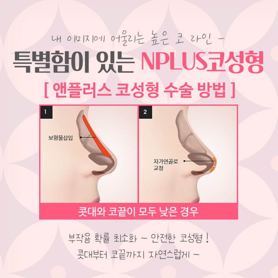 서울코수술잘하는곳 꼼꼼하게 알아보고 관련 이미지 7