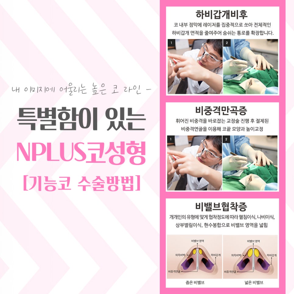 코성형잘하는곳 여러 가지를 고려하여 관련 이미지 11