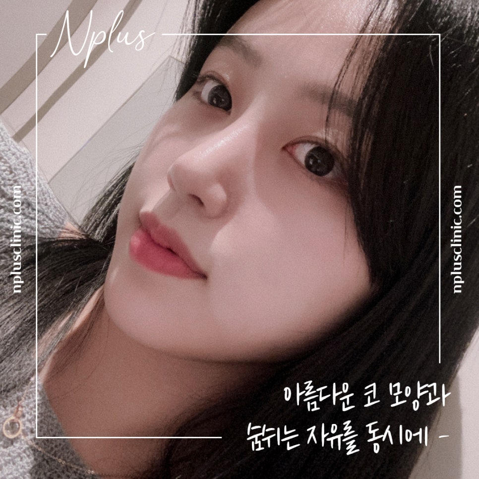 콧볼축소후기 원인을 정확하게 알아보고 관련 이미지 11