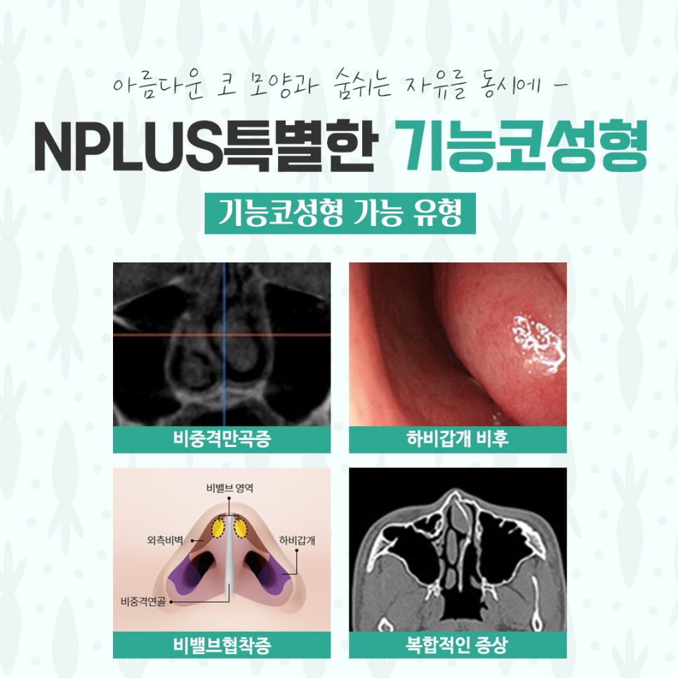 기능코수술후기 다양하게 고려하여 관련 이미지 5