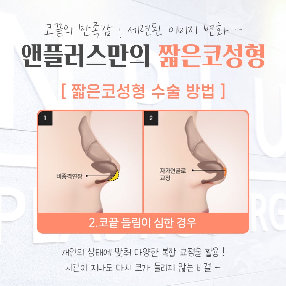 짧은코성형에 대한 차이를 알아보고 관련 이미지 10