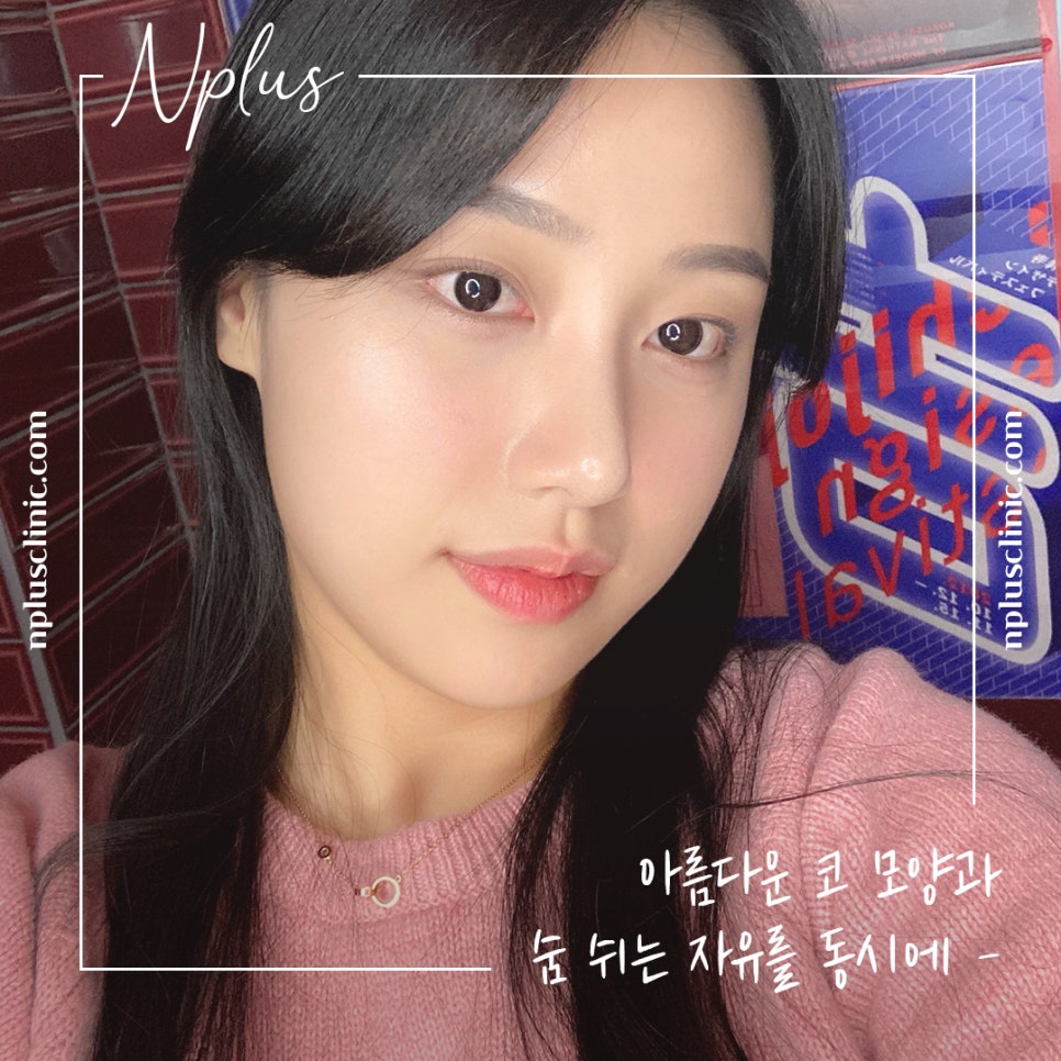 늑연골코수술을 통해 세련된 라인으로 관련 이미지 7