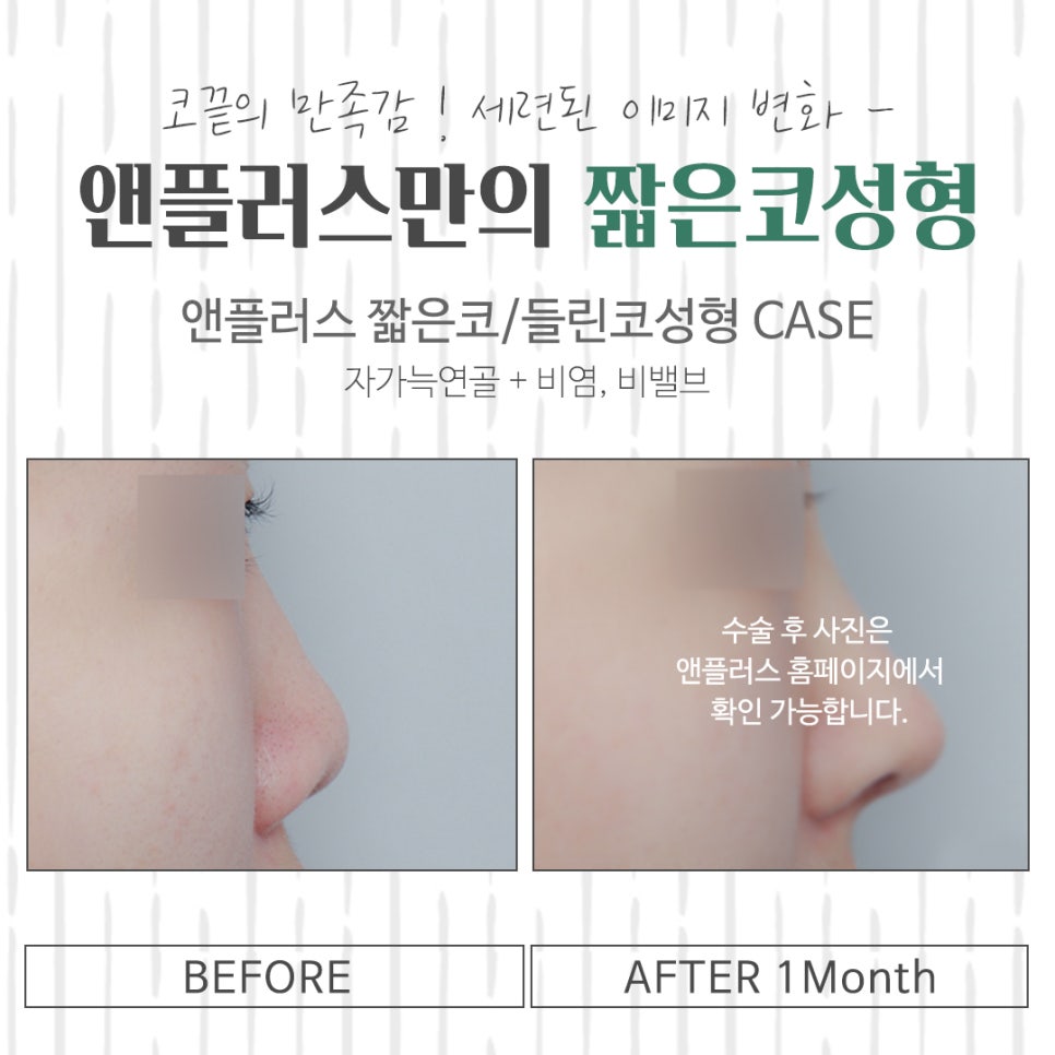 들린코수술후기 기능까지 확인하고 관련 이미지 16