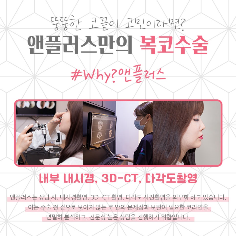 복코수술후기 뚱뚱한 코끝 개선 관련 이미지 10