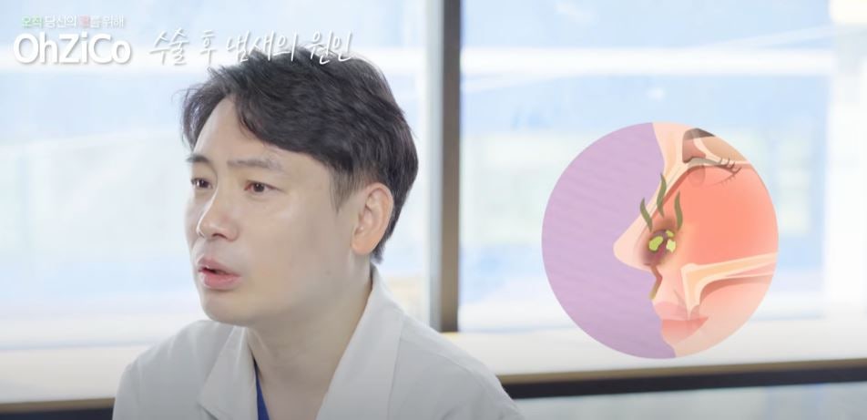 코수술 후 코냄새 원인과 해결 방법! 관련 이미지 4