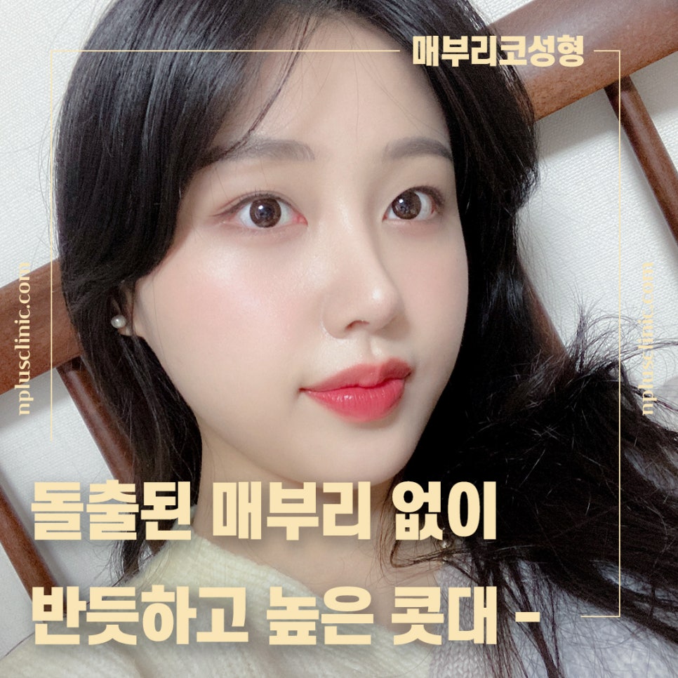 💖A+ Nose Surgery Event for the 12th Anniversary of A+ Clinic Opening💖 image 4