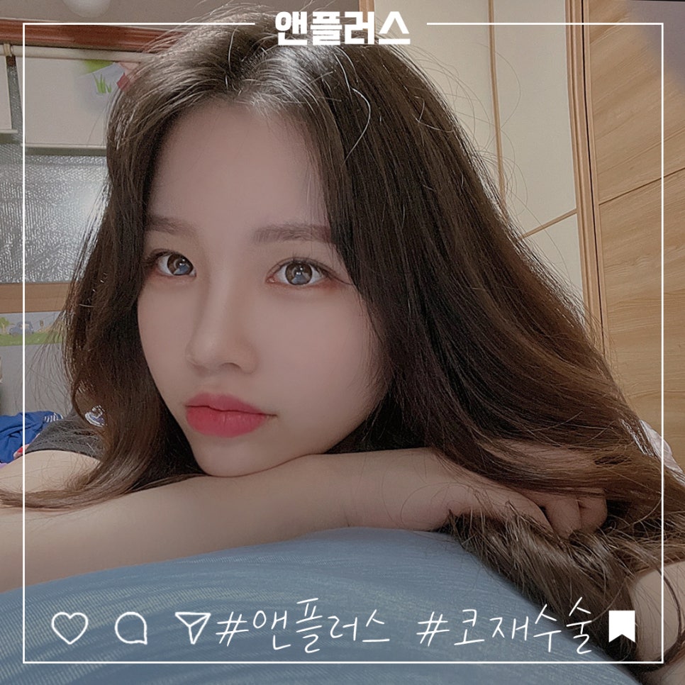 코재수술후기 자연스럽고 예쁘게 관련 이미지 1