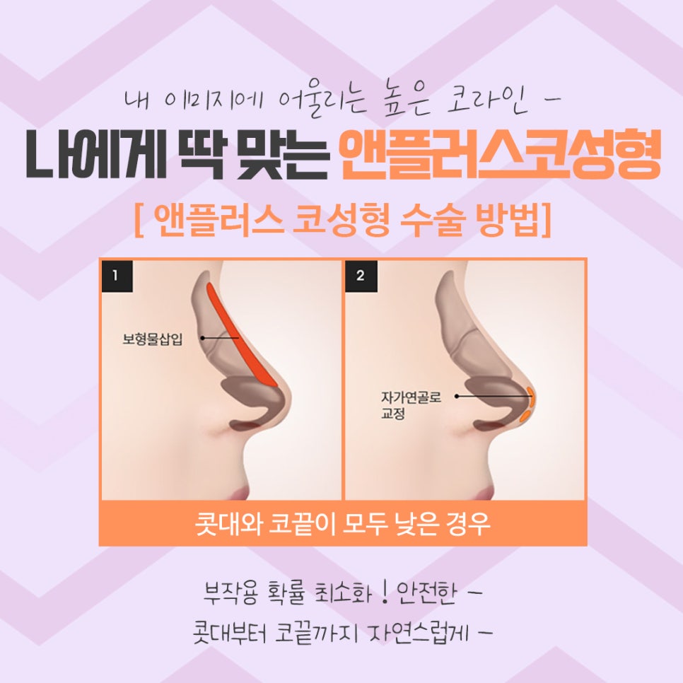 코수술후기 코 내부까지 확실하게 알아보고 관련 이미지 8