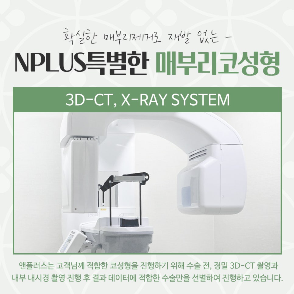 Hump Nose Surgery Review: Check Carefully image 6
