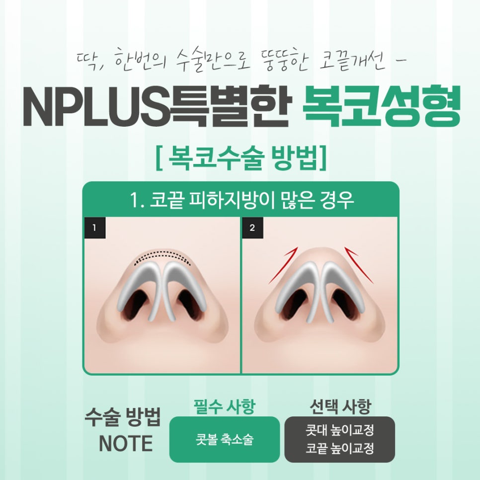Looking into Various Bulbous Nose Surgery Reviews image 7