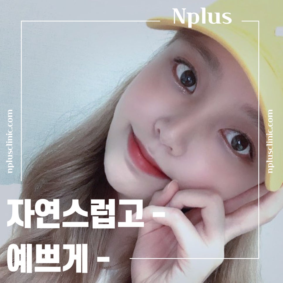 Nose Surgery Review for Correcting a Hump Nose image 15
