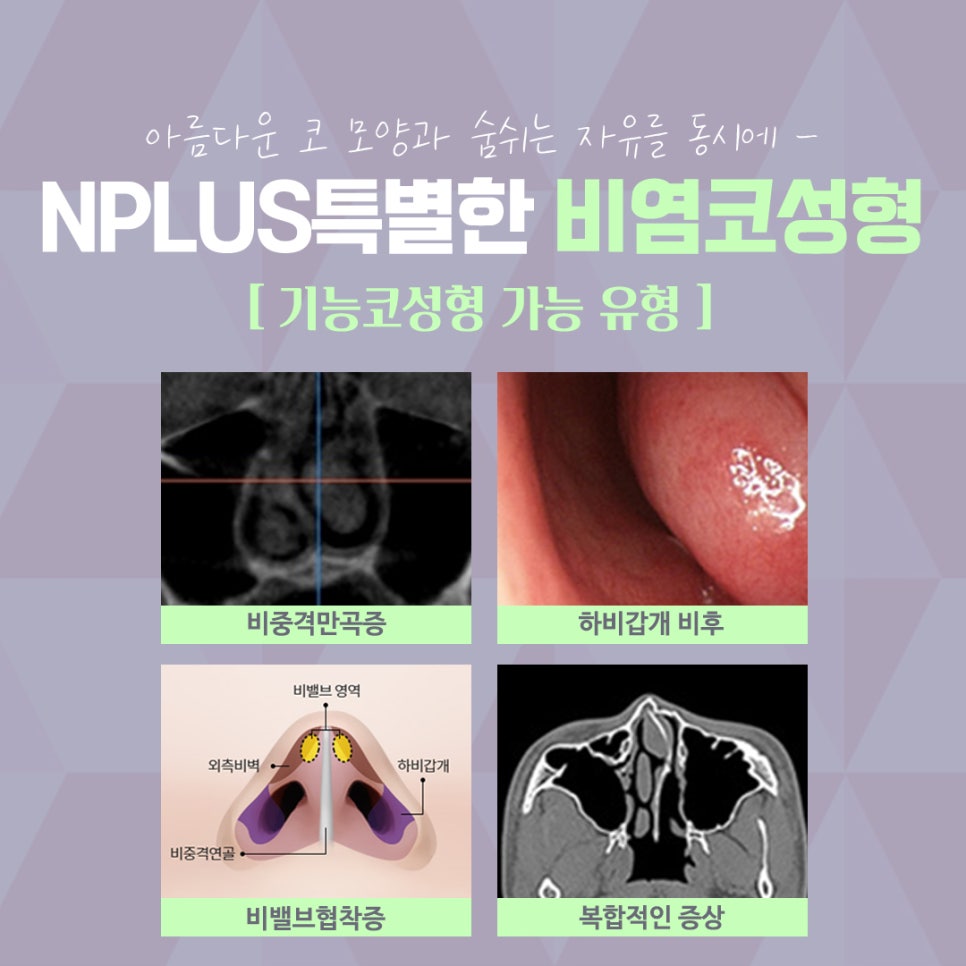 Rhinitis Surgery Review Based on an Accurate Diagnosis image 4