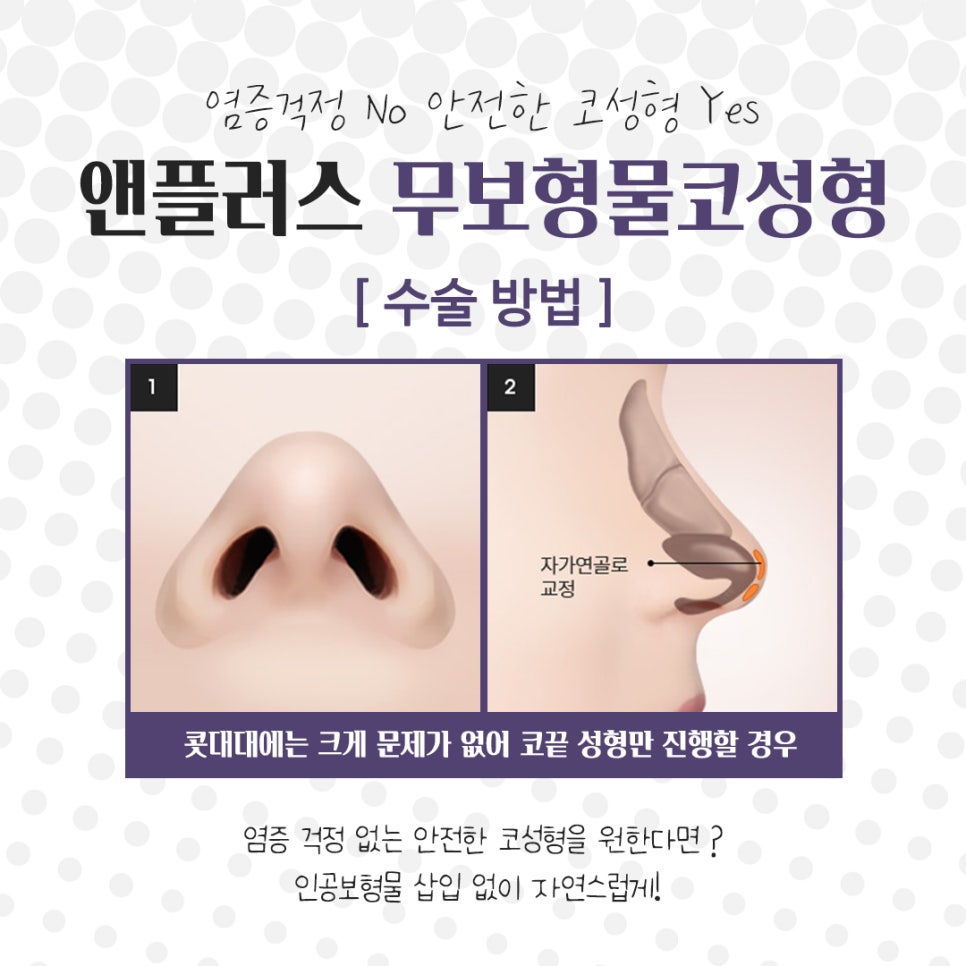 Accurately Check Non-Implant Rhinoplasty image 9