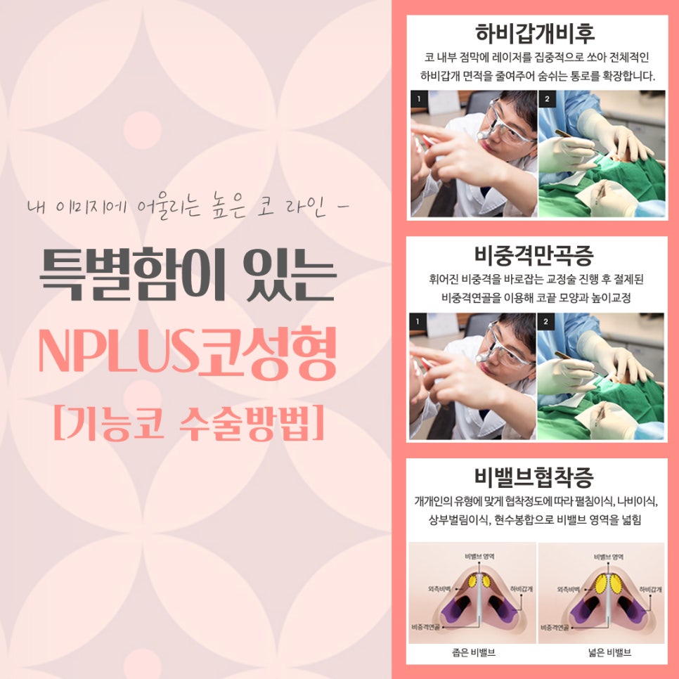 코수술 후기까지 확인하여 세련된 코라인으로 관련 이미지 11