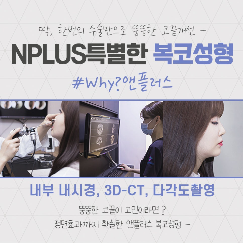 복코성형후기로 알아보는 코지방제거 관련 이미지 4