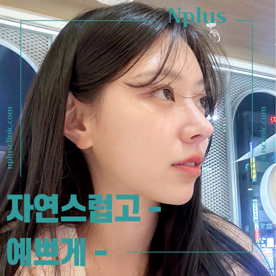 Understanding the Issues in Crooked Nose Surgery Accurately image 2