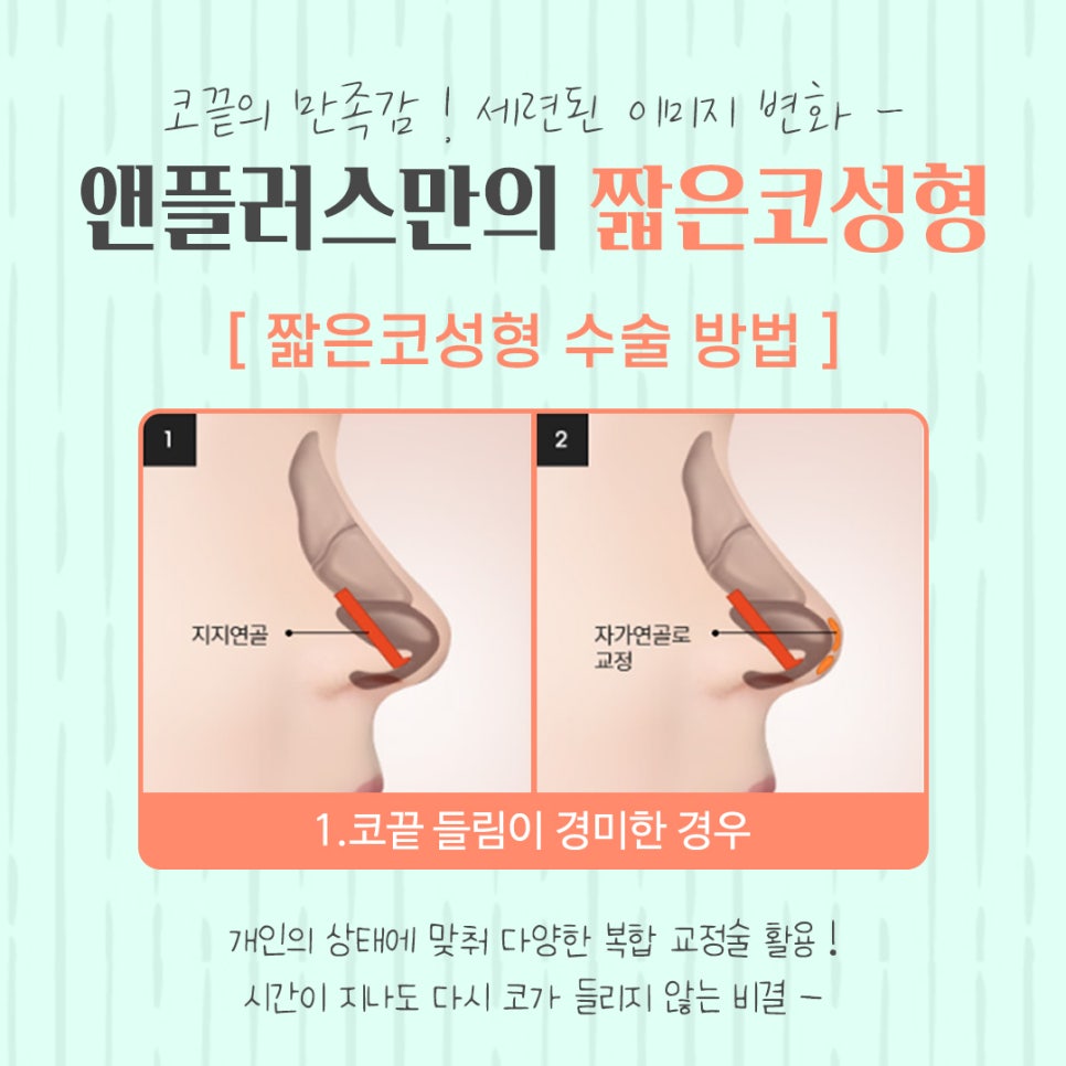 Short Nose Surgery with an Accurate Diagnosis image 9