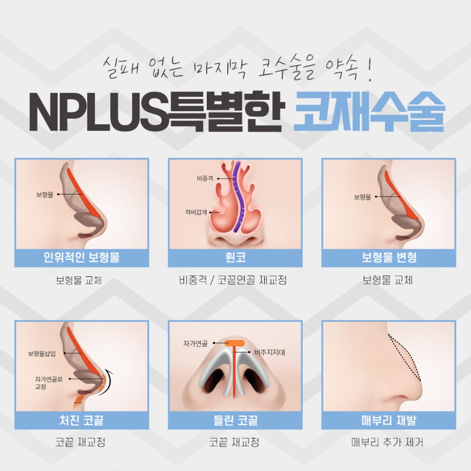 코재수술병원 자세하게 알아보고 관련 이미지 7