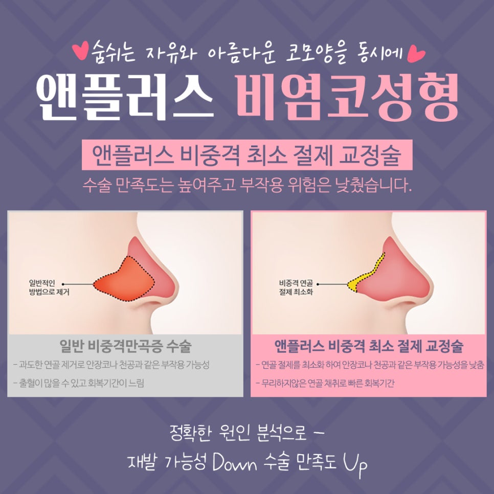 강남앤플러스 비염수술후기 관련 이미지 7