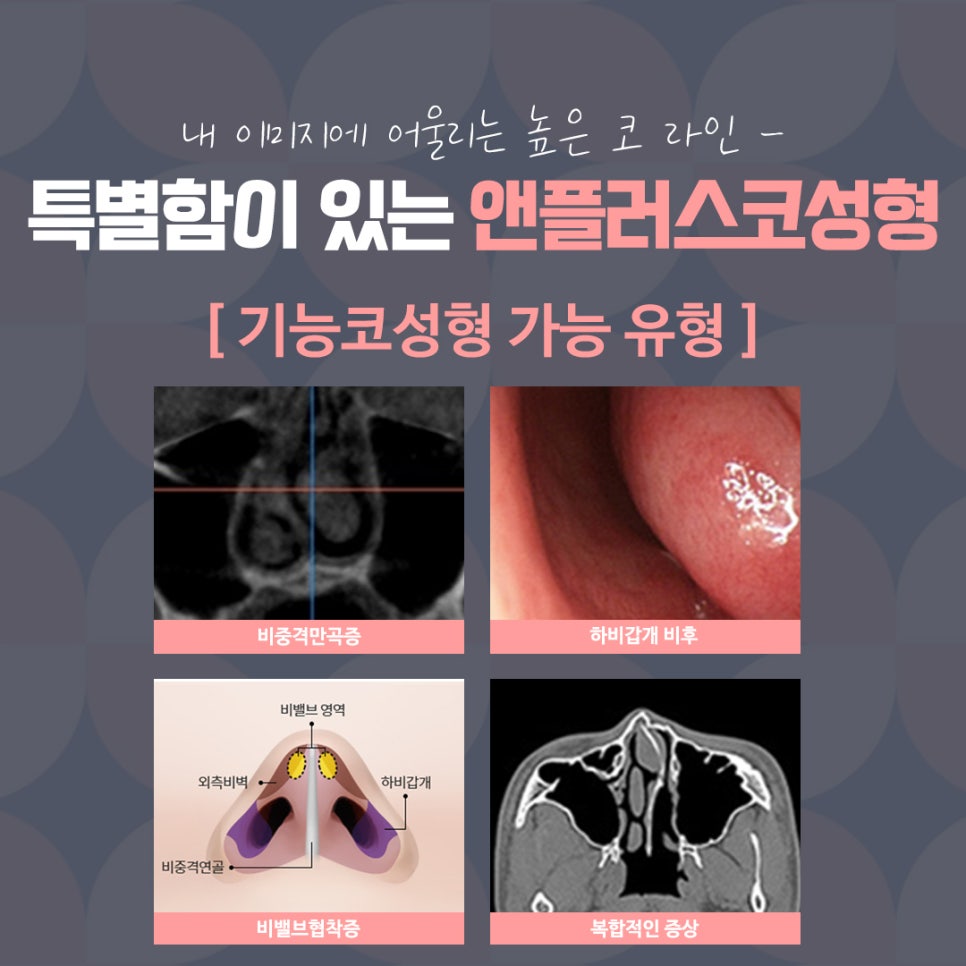 직반버선코 자연스러운 라인으로 관련 이미지 6