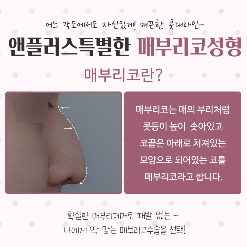 매부리코성형후기 꼼꼼하게 알아보고 관련 이미지 3