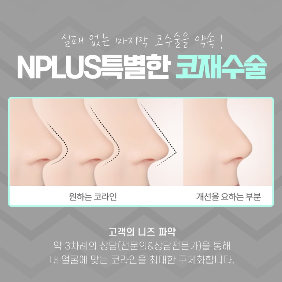 코재수술성형외과 선택의 중요성 관련 이미지 13