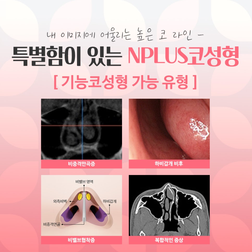If You’re Looking for Detailed Reviews of Female Rhinoplasty image 5