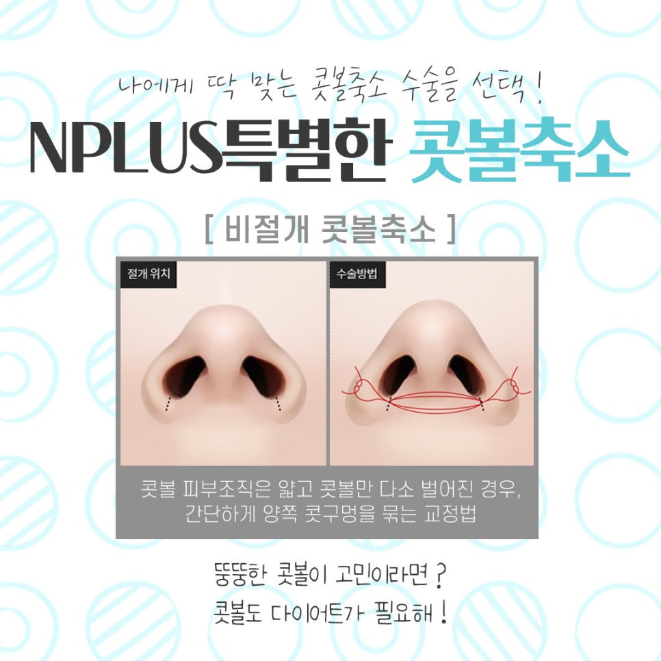 콧볼축소후기 원인을 정확하게 알아보고 관련 이미지 8