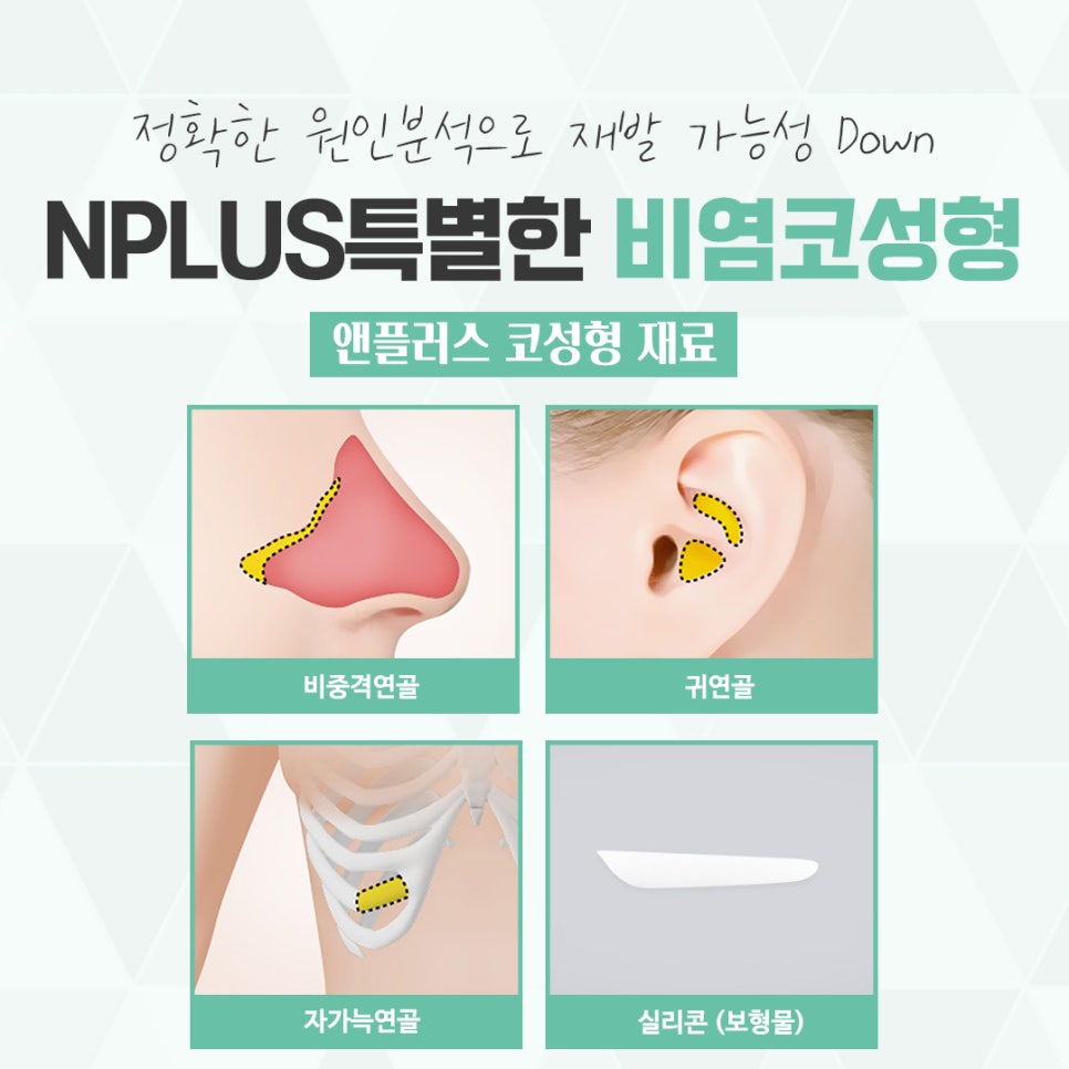 Check Nasal Surgery and Rhinoplasty in Detail image 10
