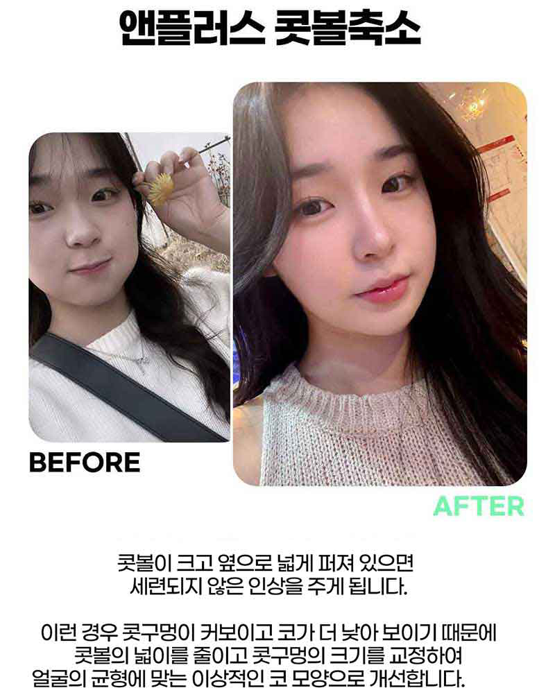 Looking into Nose Flare Reduction Reviews image 4