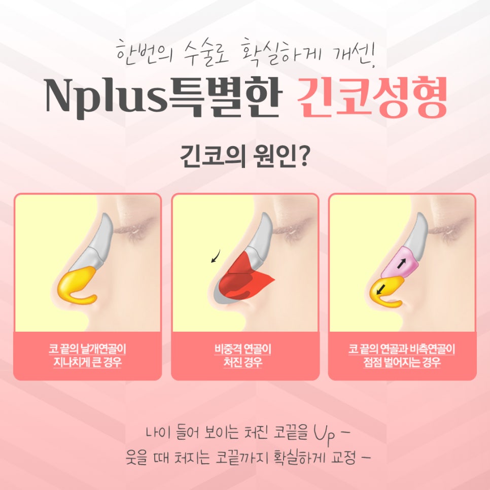 Learn More About Long Nose Surgery in Detail image 3
