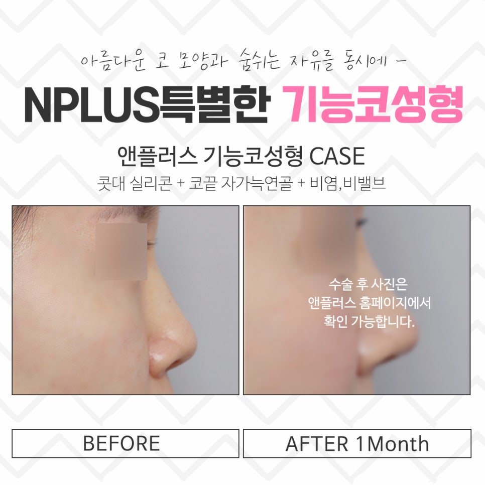 기능코수술후기 정확한 진단을 통해 관련 이미지 15