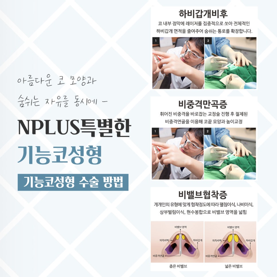기능코성형후기를 통해 개선된 점 관련 이미지 9