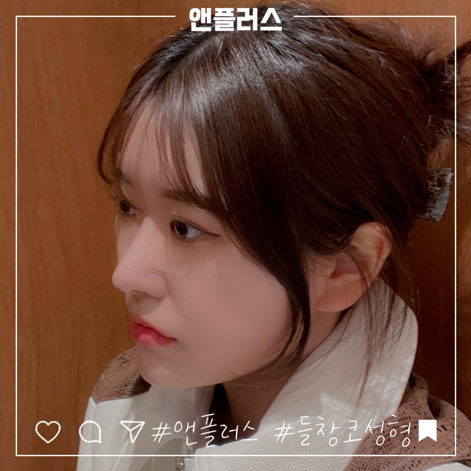 짧은코성형을 통해 세련된 이미지로 관련 이미지 2