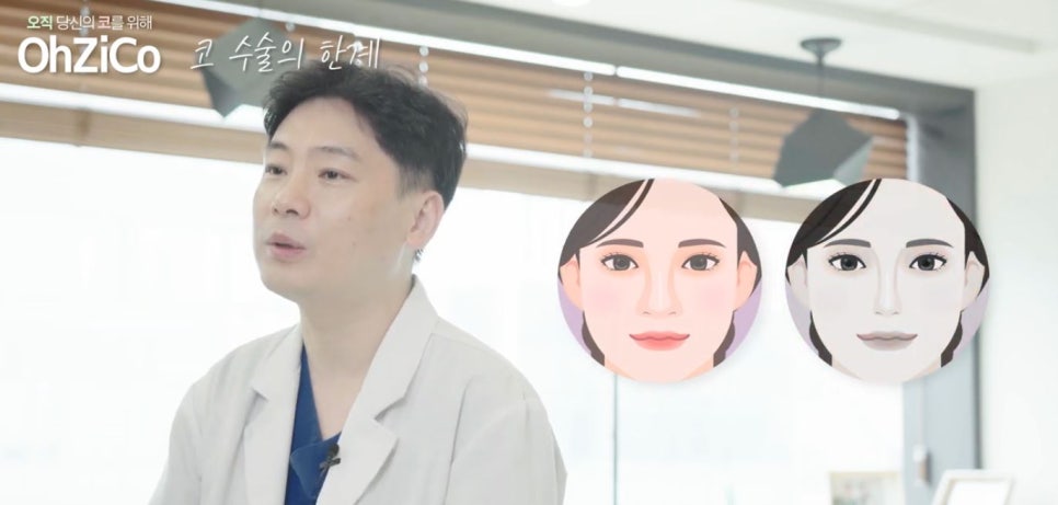 코성형 하면 예쁜코와 효과 없는 코! 관련 이미지 7