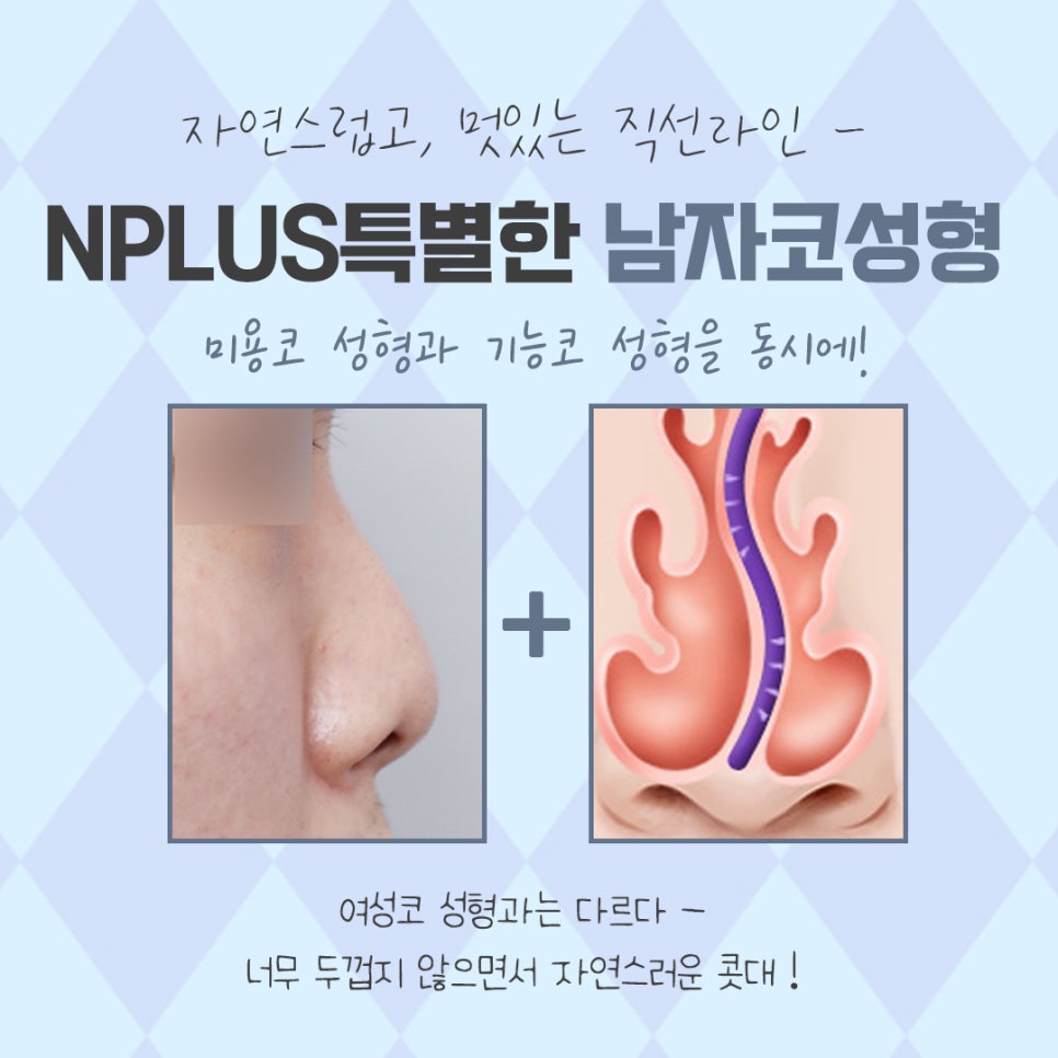 남자코성형전후 강남앤플러스에서 확인 관련 이미지 5