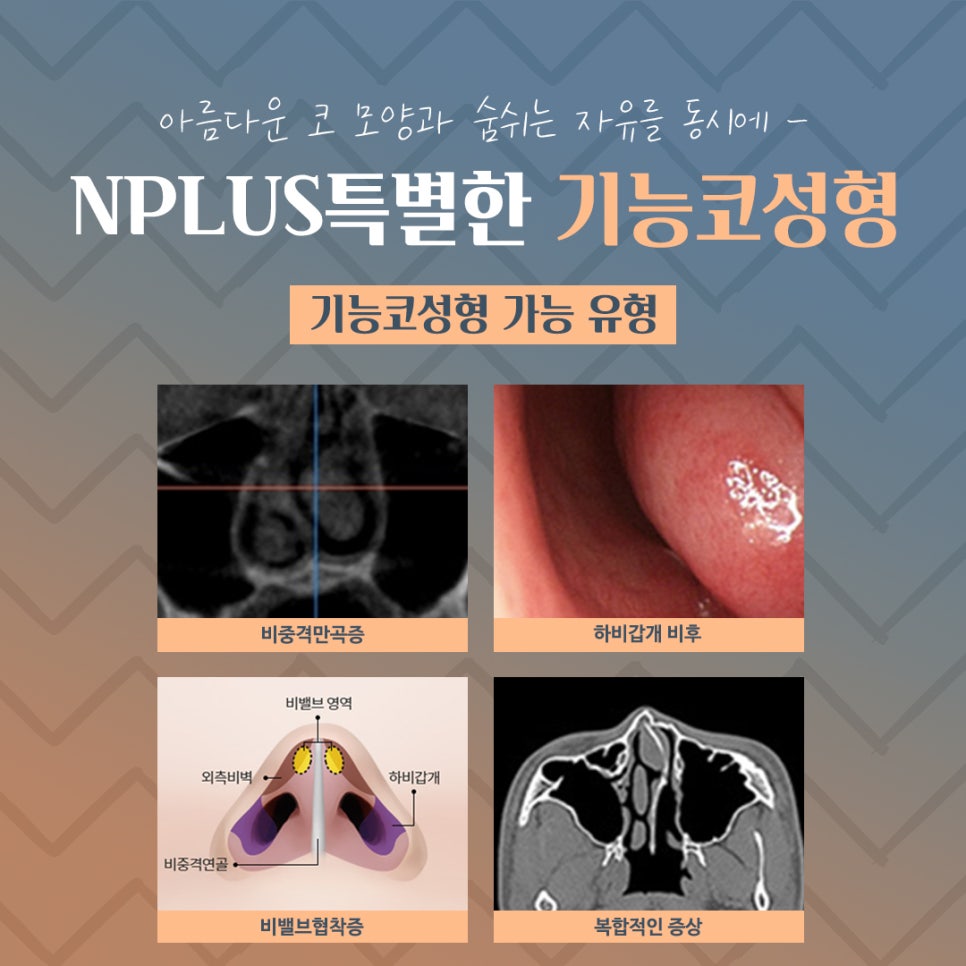 기능코후기에 대한 비교를 찾아보고 관련 이미지 4