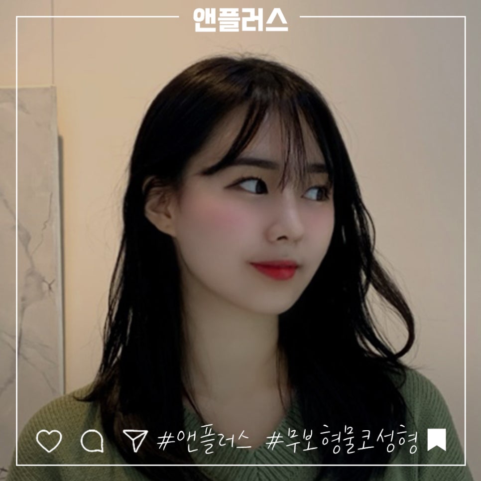 무보형물코수술 자연스러운 코 라인을 원한다면! 관련 이미지 11