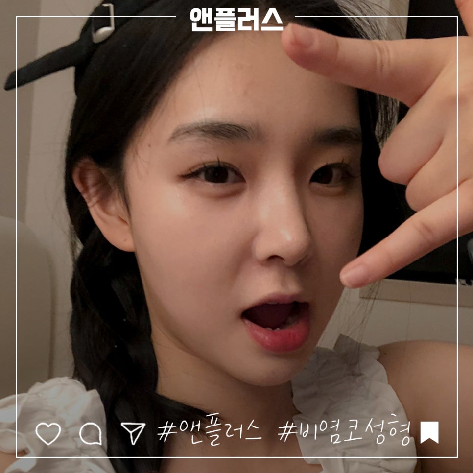 비염코수술전후에 대해 자세히 알아보고 관련 이미지 2